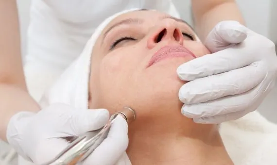 Microdermabrasion